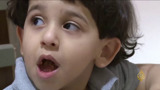 اكتشاف سبب محتمل لمرض التوحد عند الأطفال